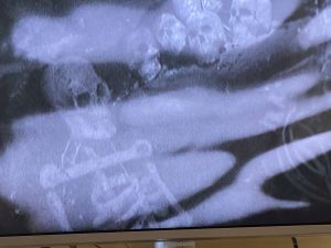 3: Running scared in The Forest of Fear